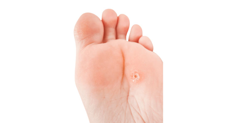 Callu-Eksteroog-Liktorn-1200x628-1