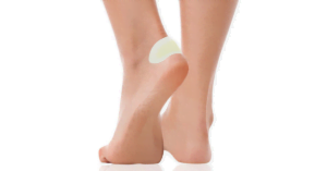 Fotblåsa täckt med skavsårsplåster