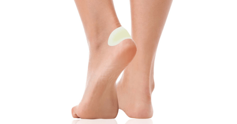 Fotblåsa täckt med skavsårsplåster