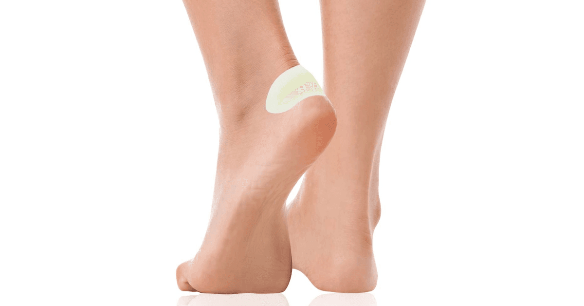 Fotblåsa täckt med skavsårsplåster